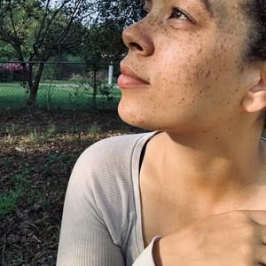 Meet your Posher, Annesia